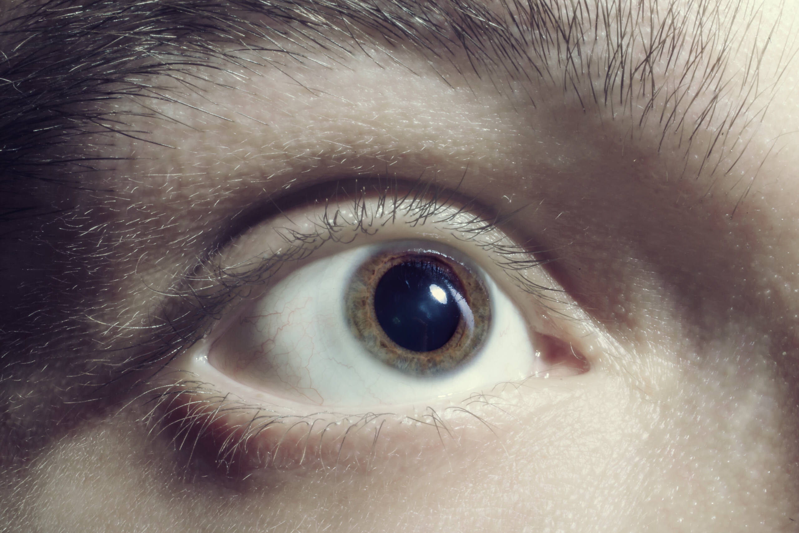 Dilated Pupil: A Sign of Cocaine Use Close-up of a dilated human eye, showing effects of cocaine use on pupil size